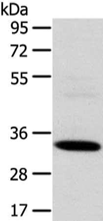 Gel: 8%SDS-PAGE, Lysate: 40 μg, Lane: Hela cell, Primary antibody: SDCBP Antibody(SDCBP Antibody) at dilution 1/500 dilution, Secondary antibody: Goat anti rabbit IgG at 1/8000 dilution, Exposure time: 3 secondsRabbit anti-Human SDCBP Polyclonal Antibody