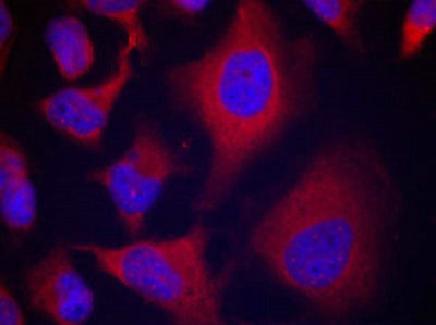 Immunofluorescence staining of methanol-fixed Hela cells using ADD1(Phospho-Ser726) Antibody.Rabbit anti-Human ADD1 Polyclonal Antibody