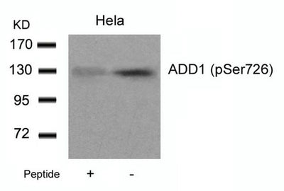 Western blot analysis of extracts from Hela cells using ADD1(Phospho-Ser726) Antibody and the same antibody preincubated with blocking peptide.