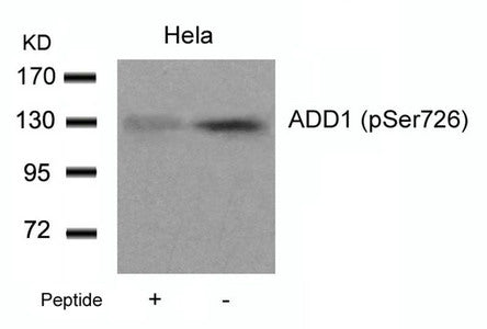 Western blot analysis of extracts from Hela cells using ADD1(Phospho-Ser726) Antibody and the same antibody preincubated with blocking peptide.Rabbit anti-Human ADD1 Polyclonal Antibody