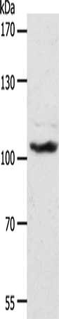 Gel: 8%SDS-PAGE, Lysate: 40 μg, Lane: NIH/3T3 cells, Primary antibody: ADAMTS17 Antibody(ADAMTS17 Antibody) at dilution 1/1300, Secondary antibody: Goat anti rabbit IgG at 1/8000 dilution, Exposure time: 1 hourRabbit anti-Human ADAMTS17 Polyclonal Antibody