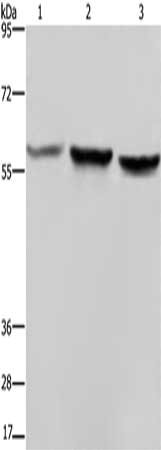 Gel: 6%SDS-PAGE, Lysate: 40 μg, Lane 1-3: Hela cells, A375 cells, LoVo cells, Primary antibody: SYN2 Antibody(SYN2 Antibody) at dilution 1/1400, Secondary antibody: Goat anti rabbit IgG at 1/8000 dilution, Exposure time: 40 secondsRabbit anti-Human SYN2 Polyclonal Antibody