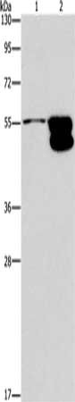 Gel: 8%SDS-PAGE, Lysate: 40 μg, Lane 1-2: NIH/3T3 cells, mouse brain tissue, Primary antibody: CRHR2 Antibody(CRHR2 Antibody) at dilution 1/650, Secondary antibody: Goat anti rabbit IgG at 1/8000 dilution, Exposure time: 10 minutesRabbit anti-Human CRHR2 Polyclonal Antibody