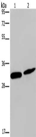 Gel: 10%SDS-PAGE, Lysate: 40 μg, Lane 1-2: Mouse skin tissue, Hela cells, Primary antibody: GJB4 Antibody(GJB4 Antibody) at dilution 1/200, Secondary antibody: Goat anti rabbit IgG at 1/8000 dilution, Exposure time: 5 minutesRabbit anti-Human GJB4 Polyclonal Antibody