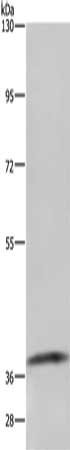 Gel: 6%SDS-PAGE, Lysate: 40 μg, Lane: Mouse kidney tissue, Primary antibody: GDF3 Antibody(GDF3 Antibody) at dilution 1/250, Secondary antibody: Goat anti rabbit IgG at 1/8000 dilution, Exposure time: 1 minuteRabbit anti-Human GDF3 Polyclonal Antibody