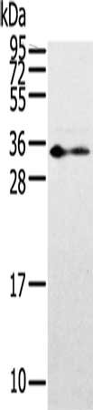 Gel: 8%SDS-PAGE, Lysate: 60 μg, Lane: Mouse small intestine tissue, Primary antibody: ANXA13 Antibody(ANXA13 Antibody) at dilution 1/400, Secondary antibody: Goat anti rabbit IgG at 1/8000 dilution, Exposure time: 2 minutesRabbit anti-Human ANXA13 Polyclonal Antibody