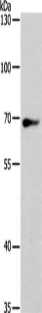 Gel: 8%SDS-PAGE, Lysate: 40 μg, Lane: Hela cells, Primary antibody: SPATA13 Antibody(SPATA13 Antibody) at dilution 1/200, Secondary antibody: Goat anti rabbit IgG at 1/8000 dilution, Exposure time: 5 seconds