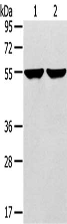 Gel: 8%SDS-PAGE, Lysate: 40 μg, Lane 1-2: 231 cells, hepg2 cells, Primary antibody: TRIM62 Antibody(TRIM62 Antibody) at dilution 1/400, Secondary antibody: Goat anti rabbit IgG at 1/8000 dilution, Exposure time: 1 minuteRabbit anti-Human TRIM62 Polyclonal Antibody