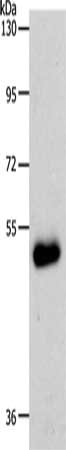 Gel: 10%SDS-PAGE, Lysate: 60 μg, Lane: Human colon cancer tissue, Primary antibody: SLC39A6 Antibody(SLC39A6 Antibody) at dilution 1/500, Secondary antibody: Goat anti rabbit IgG at 1/8000 dilution, Exposure time: 5 minutesRabbit anti-Human SLC39A6 Polyclonal Antibody