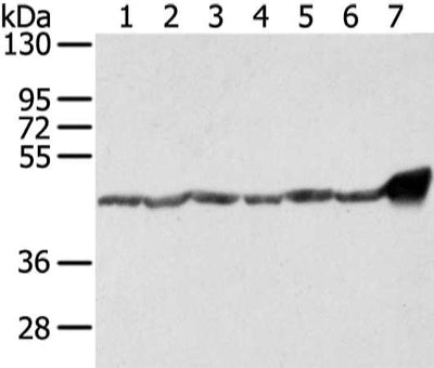 Gel: 8%SDS-PAGE, Lysate: 40 μg, Lane 1-7: 293T, hela and A431 cell, human fetal brain tissue and 231 cell, lo2 cell and mouse heart tissue, Primary antibody: UQCRC1 Antibody(UQCRC1 Antibody) at dilution 1/800 dilution, Secondary antibody: Goat anti rabbit IgG at 1/8000 dilution, Exposure time: 1 secondRabbit anti-Human UQCRC1 Polyclonal Antibody
