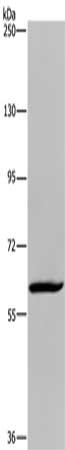 Gel: 6%SDS-PAGE, Lysate: 40 μg, Lane: Hela cells, Primary antibody: MIER2 Antibody(MIER2 Antibody) at dilution 1/550, Secondary antibody: Goat anti rabbit IgG at 1/8000 dilution, Exposure time: 10 minutes