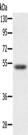 Gel: 8%SDS-PAGE, Lysate: 40 μg, Lane: Hepg2 cells, Primary antibody: PMPCB Antibody(PMPCB Antibody) at dilution 1/300, Secondary antibody: Goat anti rabbit IgG at 1/8000 dilution, Exposure time: 5 secondsRabbit anti-Human PMPCB Polyclonal Antibody