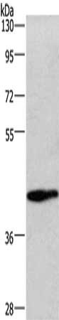 Gel: 8%SDS-PAGE, Lysate: 40 μg, Lane: Mouse lung tissue, Primary antibody: WNT3A Antibody(WNT3A Antibody) at dilution 1/325, Secondary antibody: Goat anti rabbit IgG at 1/8000 dilution, Exposure time: 2 minutesRabbit anti-Human WNT3A Polyclonal Antibody
