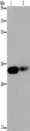 Gel: 8%SDS-PAGE, Lysate: 40 μg, Lane 1-2: Human kidney tissue, mouse lung tissue, Primary antibody: LIMS1 Antibody(LIMS1 Antibody) at dilution 1/200, Secondary antibody: Goat anti rabbit IgG at 1/8000 dilution, Exposure time: 20 seconds