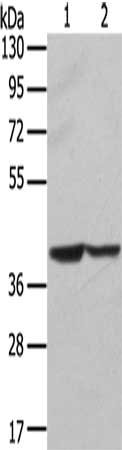 Gel: 8%SDS-PAGE, Lysate: 40 μg, Lane 1-2: Hela cells, hepg2 cells, Primary antibody: STX16 Antibody(STX16 Antibody) at dilution 1/400, Secondary antibody: Goat anti rabbit IgG at 1/8000 dilution, Exposure time: 5 secondsRabbit anti-Human STX16 Polyclonal Antibody