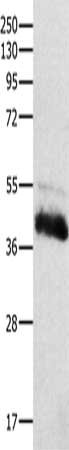 Gel: 10%SDS-PAGE, Lysate: 60 μg, Lane: Human liver cancer tissue, Primary antibody: CTSH Antibody(CTSH Antibody) at dilution 1/100, Secondary antibody: Goat anti rabbit IgG at 1/8000 dilution, Exposure time: 1 minuteRabbit anti-Human CTSH Polyclonal Antibody