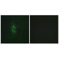 Immunofluorescence analysis of HepG2 cells, using MRC2 antibody.Rabbit anti-Human MRC2 Polyclonal Antibody