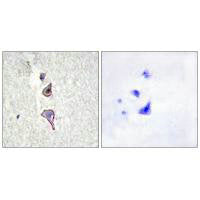 Immunohistochemistry analysis of paraffin-embedded human brain tissue using MRC2 antibody.Rabbit anti-Human MRC2 Polyclonal Antibody