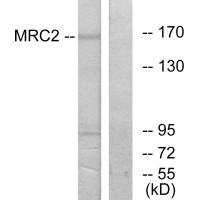 Western blot analysis of extracts from 293 cells, using MRC2 antibody.Rabbit anti-Human MRC2 Polyclonal Antibody