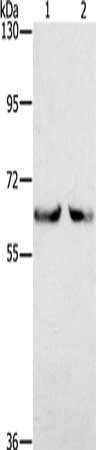 Gel: 6%SDS-PAGE, Lysate: 100 μg, Lane 1-2: Jurkat cells, K562 cells, Primary antibody: KLHL2 Antibody(KLHL2 Antibody) at dilution 1/200, Secondary antibody: Goat anti rabbit IgG at 1/8000 dilution, Exposure time: 2 minutes