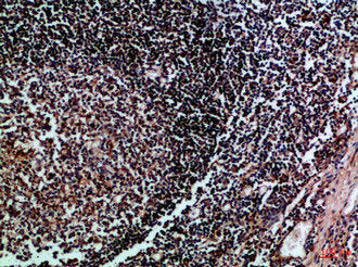 Immunohistochemical analysis of paraffin-embedded Human-tonsil, antibody was diluted at 1:100Rabbit anti-Human HLA-DMB Polyclonal Antibody