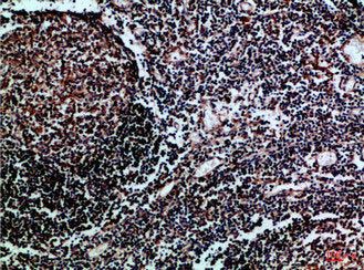 Immunohistochemical analysis of paraffin-embedded Human-tonsil, antibody was diluted at 1:100Rabbit anti-Human HLA-DMB Polyclonal Antibody