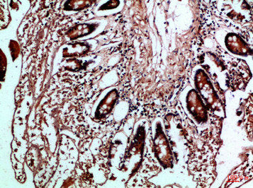 Immunohistochemical analysis of paraffin-embedded Human-colon, antibody was diluted at 1:100Rabbit anti-Human HLA-DMB Polyclonal Antibody