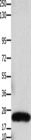 Gel: 10%SDS-PAGE, Lysate: 30 μg, Lane: Human colon cancer tissue, Primary antibody: CLDN3 Antibody(CLDN3 Antibody) at dilution 1/550, Secondary antibody: Goat anti rabbit IgG at 1/8000 dilution, Exposure time: 20 secondsRabbit anti-Human CLDN3 Polyclonal Antibody