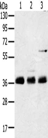 Gel: 8%SDS-PAGE, Lysate: 60 μg, Lane 1-3: Mouse lung tissue, NIH/3T3 cells, hepg2 cells, Primary antibody: ANKRD1 Antibody(ANKRD1 Antibody) at dilution 1/400, Secondary antibody: Goat anti rabbit IgG at 1/8000 dilution, Exposure time: 3 secondsRabbit anti-Human ANKRD1 Polyclonal Antibody
