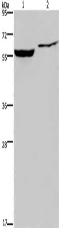 Gel: 8%SDS-PAGE, Lysate: 40 μg, Lane 1-2: Raji cells, 293T cells, Primary antibody: IMPDH1 Antibody(IMPDH1 Antibody) at dilution 1/500, Secondary antibody: Goat anti rabbit IgG at 1/8000 dilution, Exposure time: 30 secondsRabbit anti-Human IMPDH1 Polyclonal Antibody