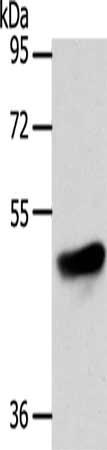 Gel: 8%SDS-PAGE, Lysate: 40μg, Lane: Mouse thymus tissue, Primary antibody: ADIPOR1 Antibody(ADIPOR1 Antibody) at dilution 1/200, Secondary antibody: Goat anti rabbit IgG at 1/8000 dilution, Exposure time: 2 minutes