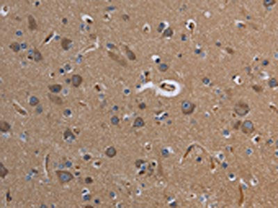 The image on the left is immunohistochemistry of paraffin-embedded Human brain  tissue using CYP3A4 Antibody(CYP3A4 Antibody) at dilution 1/40, on the right is treated with fusion protein. (Original magnification: ×200)Rabbit anti-Human CYP3A4 Polyclonal Antibody