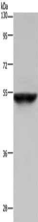 Gel: 8%SDS-PAGE, Lysate: 40 μg, Lane: Human fetal liver tissue, Primary antibody: CYP3A4 Antibody(CYP3A4 Antibody) at dilution 1/250, Secondary antibody: Goat anti rabbit IgG at 1/8000 dilution, Exposure time: 5 secondsRabbit anti-Human CYP3A4 Polyclonal Antibody
