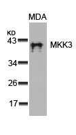 Western blot analysis of extracts from MDA cells using MKK3(Ab-189) Antibody.