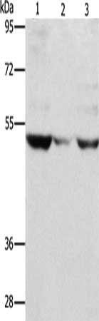 Gel: 12%SDS-PAGE, Lysate: 80 μg, Lane 1-3: PC3 cells, mouse muscle tissue, A375 cells, Primary antibody: MMP1 Antibody(MMP1 Antibody) at dilution 1/500, Secondary antibody: Goat anti rabbit IgG at 1/8000 dilution, Exposure time: 1 minuteRabbit anti-Human MMP1 Polyclonal Antibody
