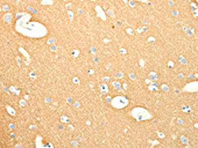 The image on the left is immunohistochemistry of paraffin-embedded Human brain tissue using the antibody Antibody) at dilution 1/25, on the right is treated with fusion protein. (Original magnification: ×200)Rabbit anti-Human SNAP25 Polyclonal Antibody