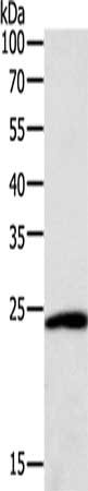 Gel: 12%SDS-PAGE, Lysate: 40 μg, Lane: Hela cells, Primary antibody: SNAP25 Antibody(SNAP25 Antibody) at dilution 1/400, Secondary antibody: Goat anti rabbit IgG at 1/8000 dilution, Exposure time: 10 secondsRabbit anti-Human SNAP25 Polyclonal Antibody