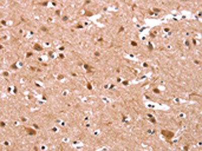 The image on the left is immunohistochemistry of paraffin-embedded Human brain  tissue using KCNJ6 Antibody(KCNJ6 Antibody) at dilution 1/40, on the right is treated with synthetic peptide. (Original magnification: ×200)