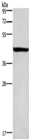 Gel: 8%SDS-PAGE, Lysate: 40 μg, Lane: A549 cells, Primary antibody: KCNJ6 Antibody(KCNJ6 Antibody) at dilution 1/600, Secondary antibody: Goat anti rabbit IgG at 1/8000 dilution, Exposure time: 1 minute