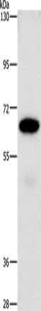 Gel: 10%SDS-PAGE, Lysate: 40 μg, Lane: A549 cells, Primary antibody: NT5E Antibody(NT5E Antibody) at dilution 1/850, Secondary antibody: Goat anti rabbit IgG at 1/8000 dilution, Exposure time: 1 secondRabbit anti-Human NT5E Polyclonal Antibody