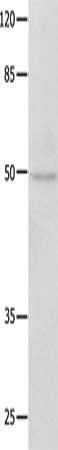 Gel: 10%SDS-PAGE, Lysate: 40 μg, Lane: Jurkat cells, Primary antibody: NAP1L1 Antibody(NAP1L1 Antibody) at dilution 1/650, Secondary antibody: Goat anti rabbit IgG at 1/8000 dilution, Exposure time: 40 secondsRabbit anti-Human NAP1L1 Polyclonal Antibody