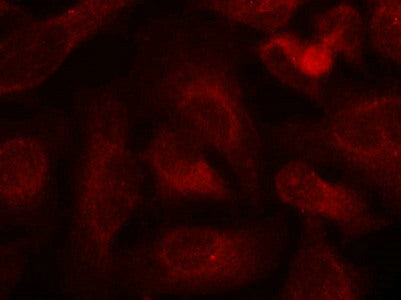 Immunofluorescence staining of methanol-fixed Hela cells using ABL1/2(phospho-Tyr393/439) Antibody.Rabbit anti-Human ABL1/ABL2 Polyclonal Antibody