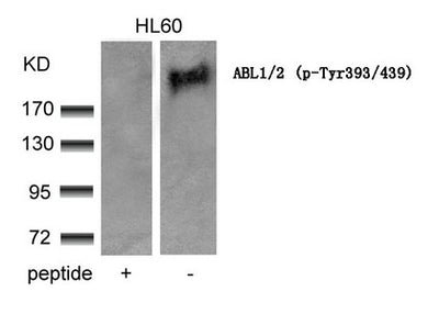 Western blot analysis of extracts from HL60 cells using ABL1/2(phospho-Tyr393/439) Antibody and the same antibody preincubated with blocking peptide.