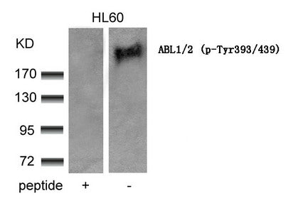 Western blot analysis of extracts from HL60 cells using ABL1/2(phospho-Tyr393/439) Antibody and the same antibody preincubated with blocking peptide.Rabbit anti-Human ABL1/ABL2 Polyclonal Antibody
