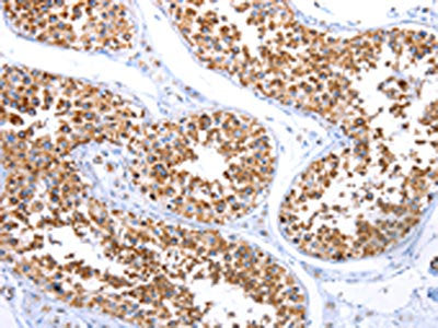 The image on the left is immunohistochemistry of paraffin-embedded Human testis tissue using MT-CO2 Antibody(MT-CO2 Antibody) at dilution 1/6, on the right is treated with synthetic peptide. (Original magnification: ×200)Rabbit anti-Human MT-CO2 Polyclonal Antibody