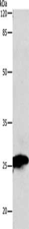 Gel: 10%SDS-PAGE, Lysate: 30 μg, Lane: Mouse heart tissue, Primary antibody: MT-CO2 Antibody(MT-CO2 Antibody) at dilution 1/150, Secondary antibody: Goat anti rabbit IgG at 1/8000 dilution, Exposure time: 30 secondsRabbit anti-Human MT-CO2 Polyclonal Antibody