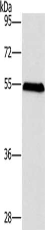 Gel: 8%SDS-PAGE, Lysate: 40 μg, Lane: Mouse liver tissue, Primary antibody: SPHK2 Antibody(SPHK2 Antibody) at dilution 1/200, Secondary antibody: Goat anti rabbit IgG at 1/8000 dilution, Exposure time: 5 minutesRabbit anti-Human SPHK2 Polyclonal Antibody