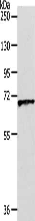 Gel: 10%SDS-PAGE, Lysate: 40 μg, Lane: Human liver cancer tissue, Primary antibody: SLC22A3 Antibody(SLC22A3 Antibody) at dilution 1/600, Secondary antibody: Goat anti rabbit IgG at 1/8000 dilution, Exposure time: 1 minuteRabbit anti-Human SLC22A3 Polyclonal Antibody