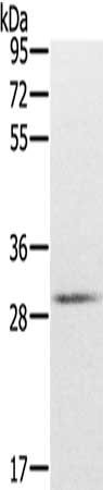 Gel: 8%SDS-PAGE, Lysate: 40 μg, Lane: Mouse brain tissue, Primary antibody: CXXC5 Antibody(CXXC5 Antibody) at dilution 1/200, Secondary antibody: Goat anti rabbit IgG at 1/8000 dilution, Exposure time: 1 minuteRabbit anti-Human CXXC5 Polyclonal Antibody