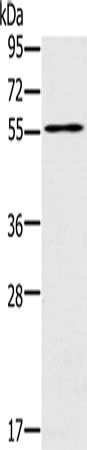 Gel: 8%SDS-PAGE, Lysate: 40 μg, Lane: Mouse intestinum tenue tissue, Primary antibody: PUS10 Antibody(PUS10 Antibody) at dilution 1/200, Secondary antibody: Goat anti rabbit IgG at 1/8000 dilution, Exposure time: 3 secondsRabbit anti-Human PUS10 Polyclonal Antibody